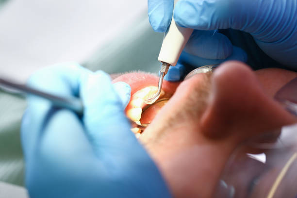 Best Emergency Treatment for Dental Infections or Abscesses in Red Cloud, NE