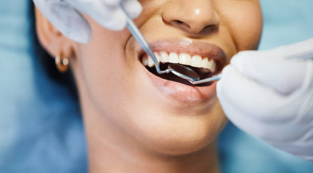 Best Emergency Dental Care for Broken or Chipped Teeth in Red Cloud, NE