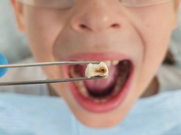 Best Emergency TMJ Treatment in Red Cloud, NE